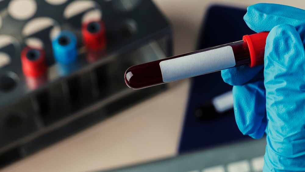 Surgeon holding a coronavirus blood test tube