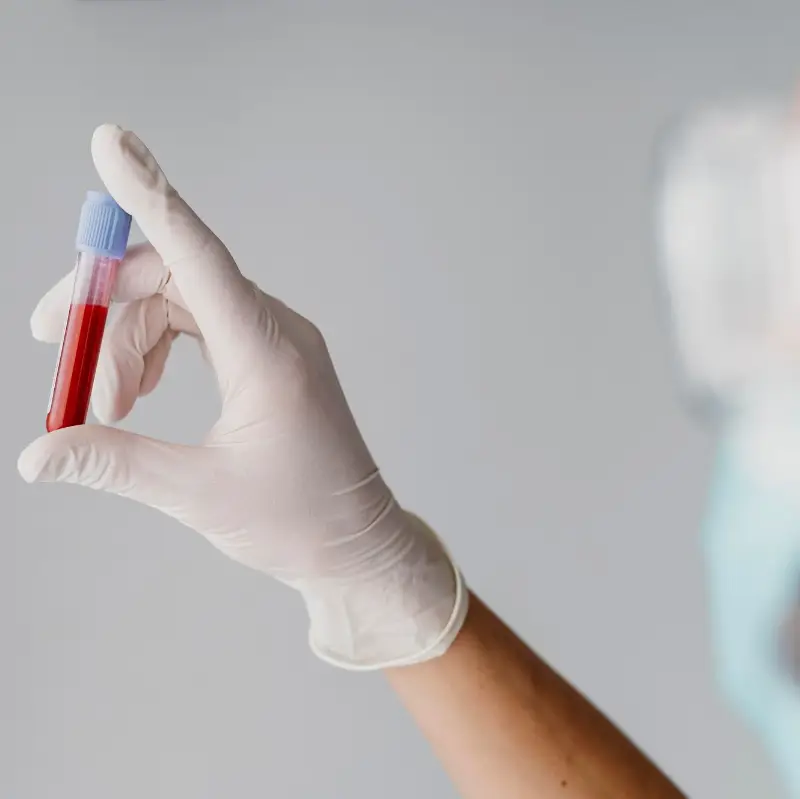 Back view doctor holding a blood sample